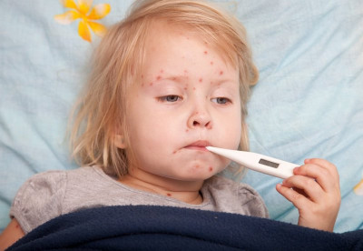 Nguyên nhân và Dấu hiệu nhận biết trẻ bị sốt virus