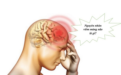 Nguyên nhân và triệu chứng của bệnh viêm màng não