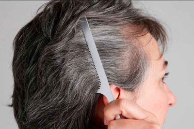 Nguyên nhân khiến tóc bạc sớm và cách điều trị