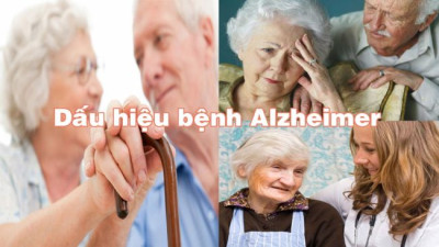 Alzheimer là bệnh gì? Cách điều trị hiệu quả?