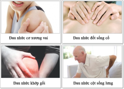 Nguyên nhân, triệu chứng và cách điều trị viêm xương khớp